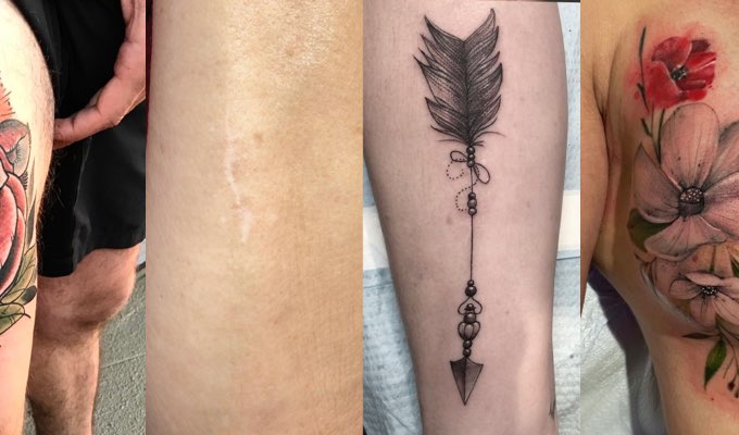 Scar coverup tattoos