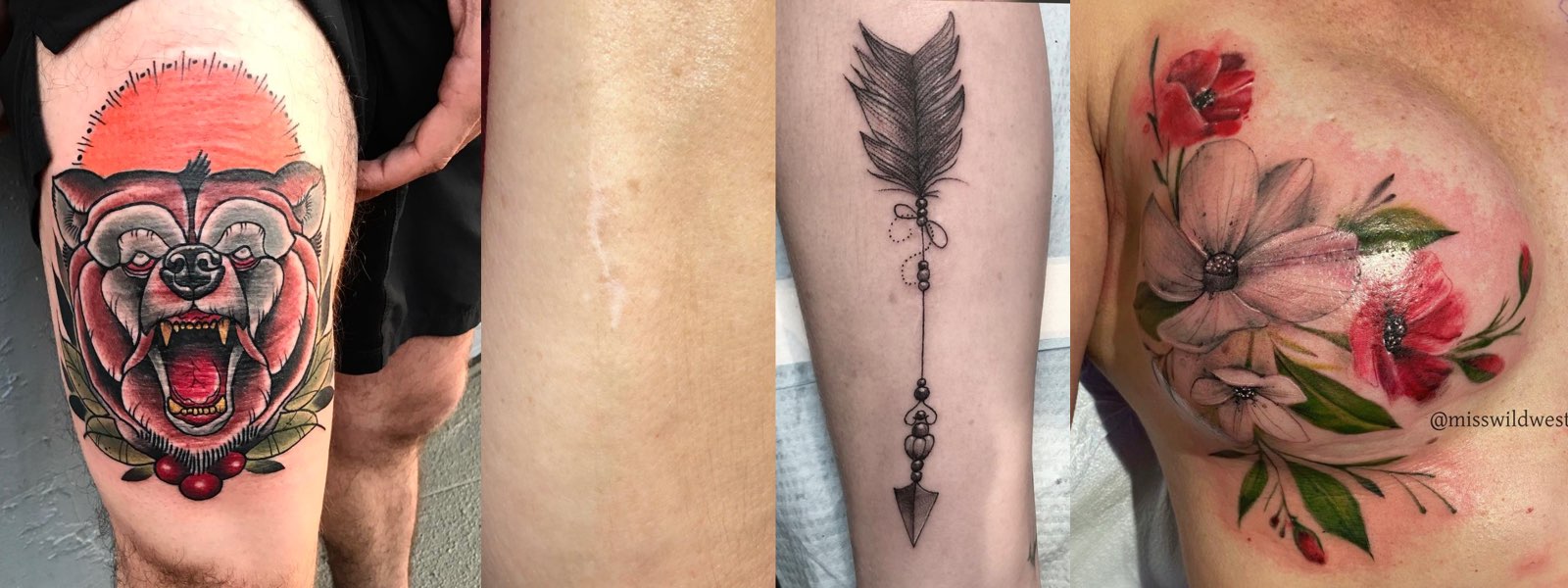 selfharm scar coverups  bella rose tattoo