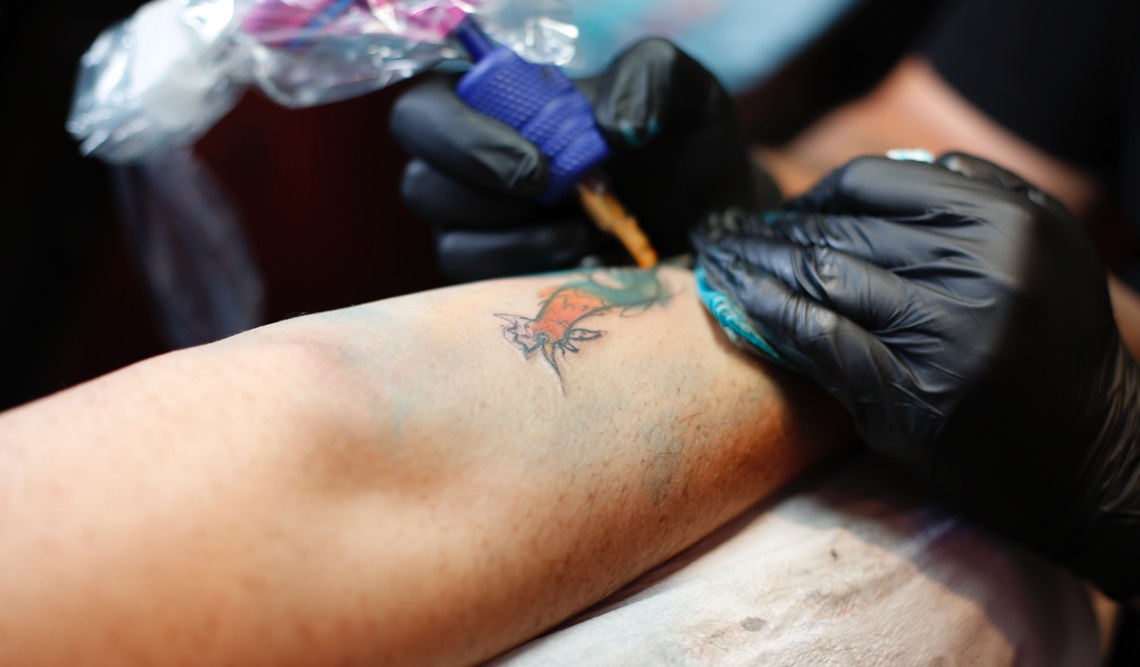 Starting Over What You Should Know About Tattoo Removal Holladay  Dermatology  Aesthetics Dermatology and Aesthetic Specialists